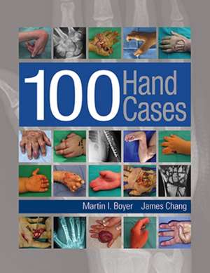 Boyer, M: 100 Hand Cases de James Chang