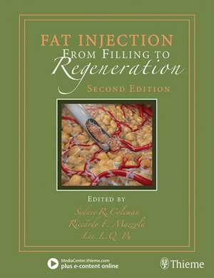 Fat Injection: From Filling to Regeneration de Sydney Coleman