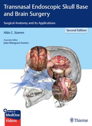 Transnasal Endoscopic Skull Base and Brain Surge – Surgical Anatomy and its Applications de Aldo C. Stamm