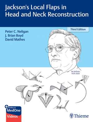 Jackson′s Local Flaps in Head and Neck Reconstruct ion de P Neligan