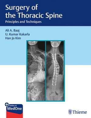 Surgery of the Thoracic Spine – Principles and Techniques de Ali A. Baaj