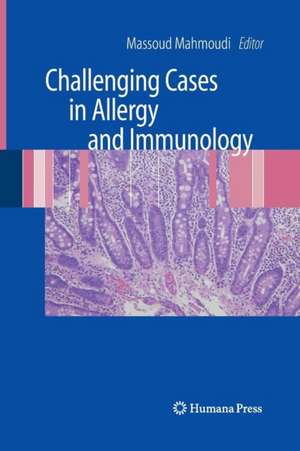 Challenging Cases in Allergy and Immunology de Massoud Mahmoudi