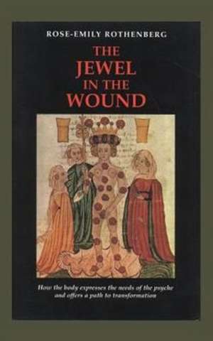 The Jewel in the Wound de Rose-Emily Rothenberg