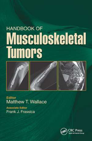 Handbook of Musculoskeletal Tumors de Matthew Wallace