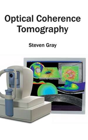 Optical Coherence Tomography de Steven Gray