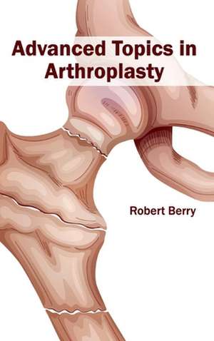 Advanced Topics in Arthroplasty de Robert Berry