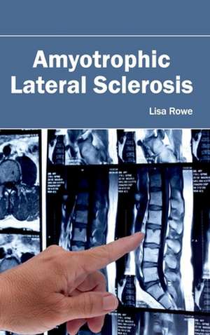 Amyotrophic Lateral Sclerosis de Lisa Rowe