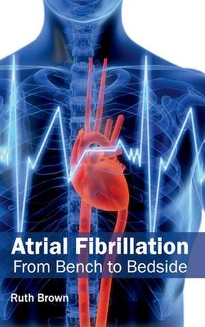 Atrial Fibrillation de Ruth Brown