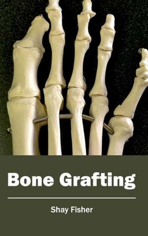 Bone Grafting de Shay Fisher