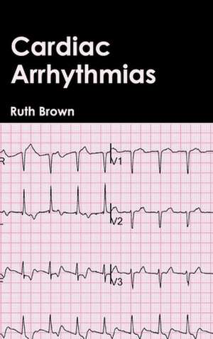 Cardiac Arrhythmias de Ruth Brown