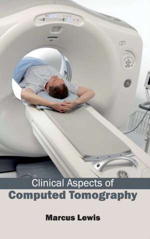 Clinical Aspects of Computed Tomography de Marcus Lewis