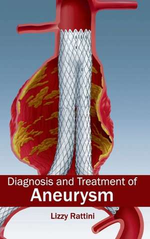 Diagnosis and Treatment of Aneurysm de Lizzy Rattini