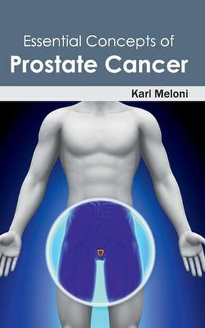 Essential Concepts of Prostate Cancer de Karl Meloni