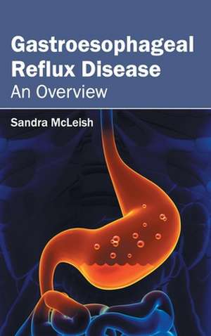 Gastroesophageal Reflux Disease de Sandra McLeish