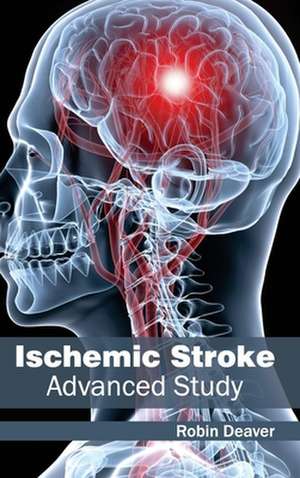 Ischemic Stroke de Robin Deaver