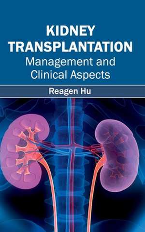 Kidney Transplantation de Reagen Hu