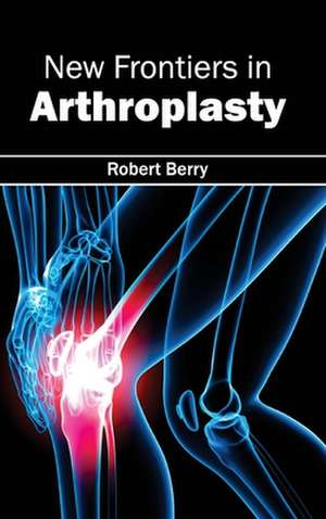 New Frontiers in Arthroplasty de Robert Berry