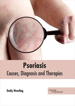 Psoriasis de Emily Howling