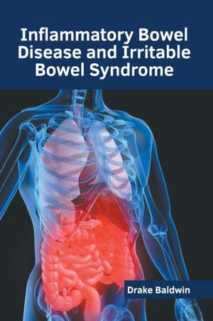 Inflammatory Bowel Disease and Irritable Bowel Syndrome de Drake Baldwin