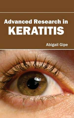 Advanced Research in Keratitis de Abigail Gipe