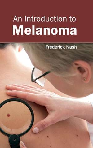 Introduction to Melanoma: History, Mechanism and Advances de Frederick Nash