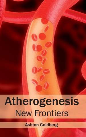 Atherogenesis de Ashton Goldberg