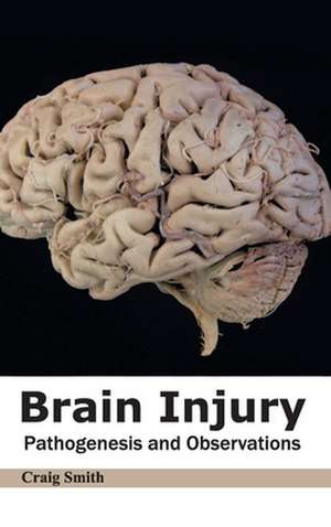 Brain Injury de Craig Smith