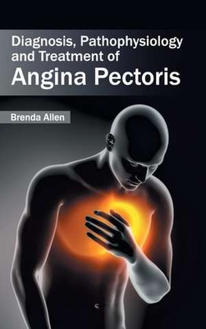 Diagnosis, Pathophysiology and Treatment of Angina Pectoris de Brenda Allen