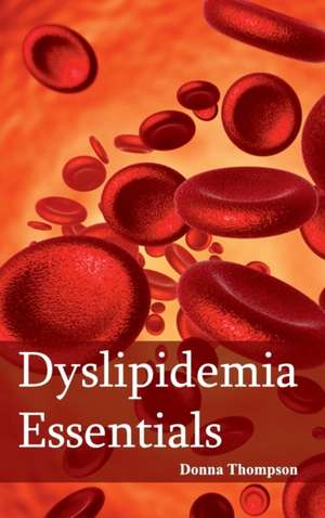 Dyslipidemia Essentials de Donna Thompson