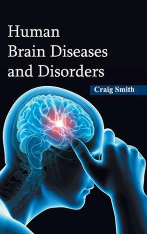 Human Brain Diseases and Disorders de Craig Smith