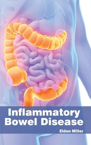 Inflammatory Bowel Disease de Eldon Miller