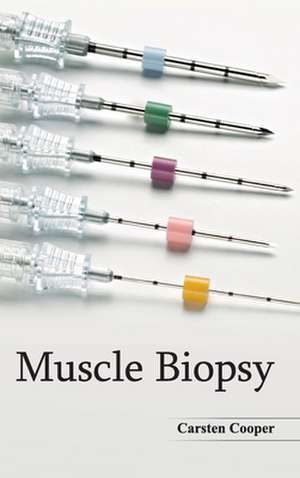 Muscle Biopsy de Carsten Cooper