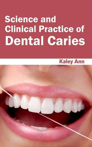 Science and Clinical Practice of Dental Caries de Kaley Ann