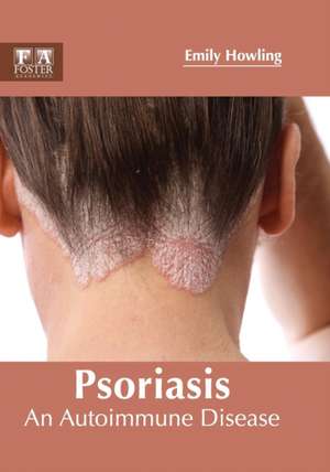 Psoriasis de Emily Howling