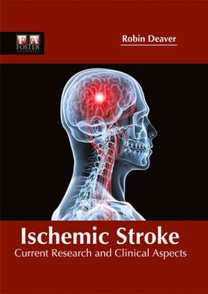 Ischemic Stroke de Robin Deaver