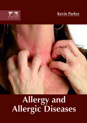 Allergy and Allergic Diseases de Kevin Parker