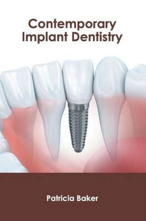 Contemporary Implant Dentistry de Patricia Baker