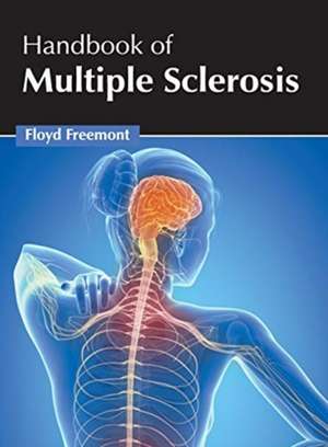 Handbook of Multiple Sclerosis de Floyd Freemont