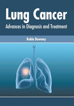 Lung Cancer: Advances in Diagnosis and Treatment de Robin Downey