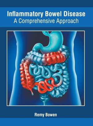 Inflammatory Bowel Disease: A Comprehensive Approach de Remy Bowen