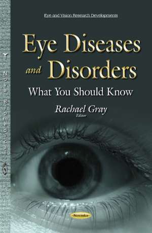 Eye Diseases & Disorders: What You Should Know de Rachael Gray