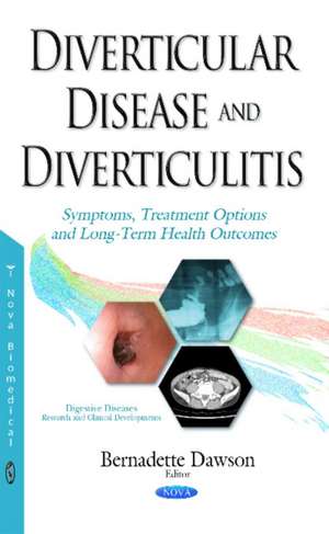 Diverticular Disease & Diverticulitis: Symptoms, Treatment Options & Long-Term Health Outcomes de Bernadette Dawson