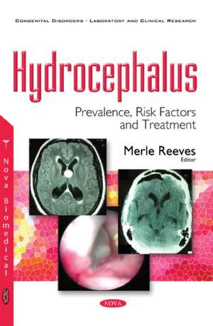 Hydrocephalus: Prevalence, Risk Factors & Treatment de Merle Reeves