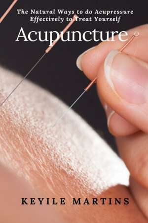 Acupuncture de Keyile Martins