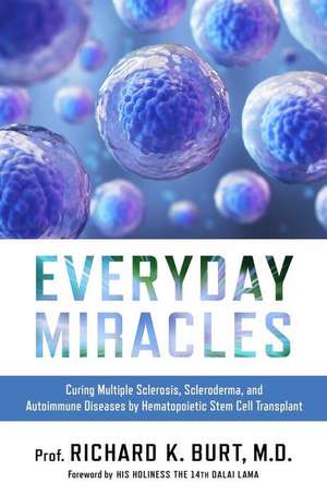 Everyday Miracles de Burt