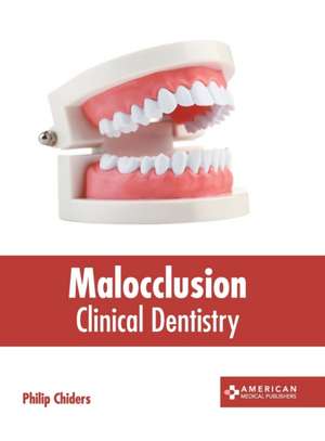 Malocclusion: Clinical Dentistry de Philip Chiders