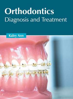 Orthodontics: Diagnosis and Treatment