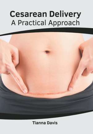 Cesarean Delivery: A Practical Approach de Tianna Davis