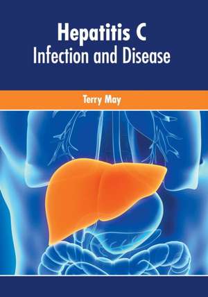 Hepatitis C: Infection and Disease de Terry May