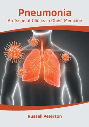 Pneumonia: An Issue of Clinics in Chest Medicine de Russell Peterson